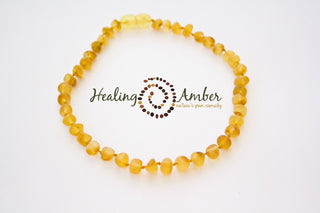 Healing Amber Raw Gold Baltic Amber Necklace - 11 Inch